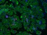 Thumbnail for dataset SuppFigure1d_6W_Pan-CK_Foxc1