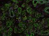 Thumbnail for dataset SuppFigure1d_P5_Pan-CK_Foxc1