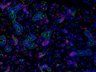 Thumbnail for dataset SuppFigure1e_6W_K18_Foxc1