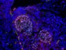 Thumbnail for dataset SuppFigure1g_E13_Sox9_Foxc1