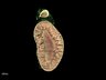 Thumbnail for dataset Fig4_kidney_Z