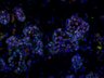 Thumbnail for dataset SuppFigure1g_E16_Sox9_Foxc1