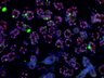 Thumbnail for dataset SuppFigure1g_P5_Sox9_Foxc1