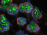 Thumbnail for dataset SuppFigure6a_E17_AQP5_SMA_DAPI