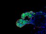 Thumbnail for dataset SuppFigure6b_d23_AQP5_SMA_DAPI