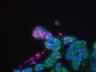 Thumbnail for dataset SuppFigure7a_d23_Pan-CK_Ki67