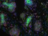 Thumbnail for dataset SuppFigure7a_E15_Pan-CK_Ki67