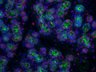 Thumbnail for dataset SuppFigure7a_E18_Pan-CK_Ki67
