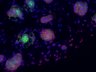 Thumbnail for dataset SuppFigure7b_E15_Pan-CK_Kit