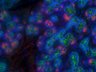 Thumbnail for dataset SuppFigure7e_E18_Pan-CK_PSP