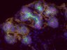 Thumbnail for dataset SuppFigure7f_E15_Pan-CK_Mist1