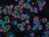 Thumbnail for dataset SuppFigure7f_E18_Pan-CK_Mist1