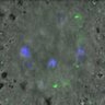 Thumbnail for Figure3B_140408_KNL1_pS24_ACA_120min