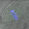 Thumbnail for Figure3C_141114_Hec1_ACA_dil2500_MII