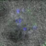 Thumbnail for dataset Figure4DE_140514_B56e_ACA_BubR1-WT_120min
