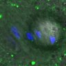 Thumbnail for dataset Figure5A_140416_KNL1pS24_ACA_BubR1-WT