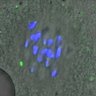 Thumbnail for dataset Figure5B_140425_KNL1pS24_ACA_BubR1-3A
