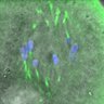 Thumbnail for dataset Figure5E_150121_MT_ACA_BubR1-3A_B56e-mNeonGreen-Nsl1