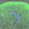 Thumbnail for dataset Figure5E_150128_MT_ACA_BubR1-3A_B56e-mNeonGreen