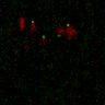 Thumbnail for Figure7B_120716_L5_con3