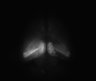 Thumbnail for dataset Fig4C_Thy1-YFP-H_Tg