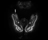 Thumbnail for dataset Fig3A_R26-pCAG-nuc-3xmKate2