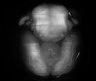 Thumbnail for dataset Fig3D_H2B-EGFP