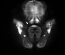 Thumbnail for dataset Fig3E_Thy1-YFP-H