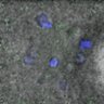 Thumbnail for dataset FigureS4D_140521_B56e_ACA_Ccnb1-mEGFPI
