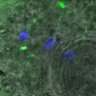 Thumbnail for dataset FigureS5C_131031_MT_ACA_AZD_BubR1-3D