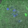 Thumbnail for FigureS6E_Hec1-pS55_ACA_140813_AZD
