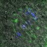 Thumbnail for dataset FigureS7A_131026_MT_ACA_AZD