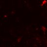 Thumbnail for dataset Figure5DF_MEKi_CD8_1