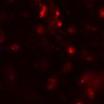 Thumbnail for dataset Figure5DF_MEKi_CD8_2