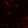 Thumbnail for dataset Figure5DF_MEKi_DP2