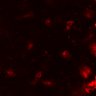 Thumbnail for dataset Figure7BE_0309_CD4_KO4