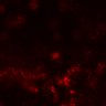 Thumbnail for Figure7BE_0310_CD8_KO