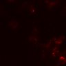 Thumbnail for dataset Figure7BE_0409_CD8_KO2