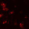 Thumbnail for Figure7BE_0409_CD8_KO4