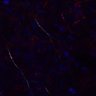 Thumbnail for dataset Video1_afterCD3