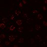 Thumbnail for dataset Figure1EF_MEKi_pre_snap