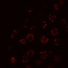 Thumbnail for dataset Figure1EF_MEKi_pst_snap