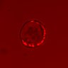 Thumbnail for Figure4A_20160709_ErkNLS_ErbB2i_pre