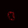 Thumbnail for dataset Figure4B_ErbB2i_pre_1