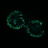 Thumbnail for dataset Figure5A_20170423_ERK_Normal_Pre_3