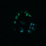 Thumbnail for dataset Figure5B_20170417_d_ERK_Adenoma_4