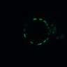 Thumbnail for dataset Figure5D_EGFRi_and_ErbB2i_post2