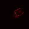 Thumbnail for Figure6B_20161208_ErkNLS_24hrCHIR_3