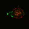 Thumbnail for dataset Figure6H_Fucci2a_EGFRi_4
