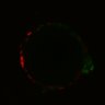 Thumbnail for dataset Figure6H_Fucci2a_EGFRi_6